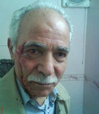 dr-peyman-02.jpg